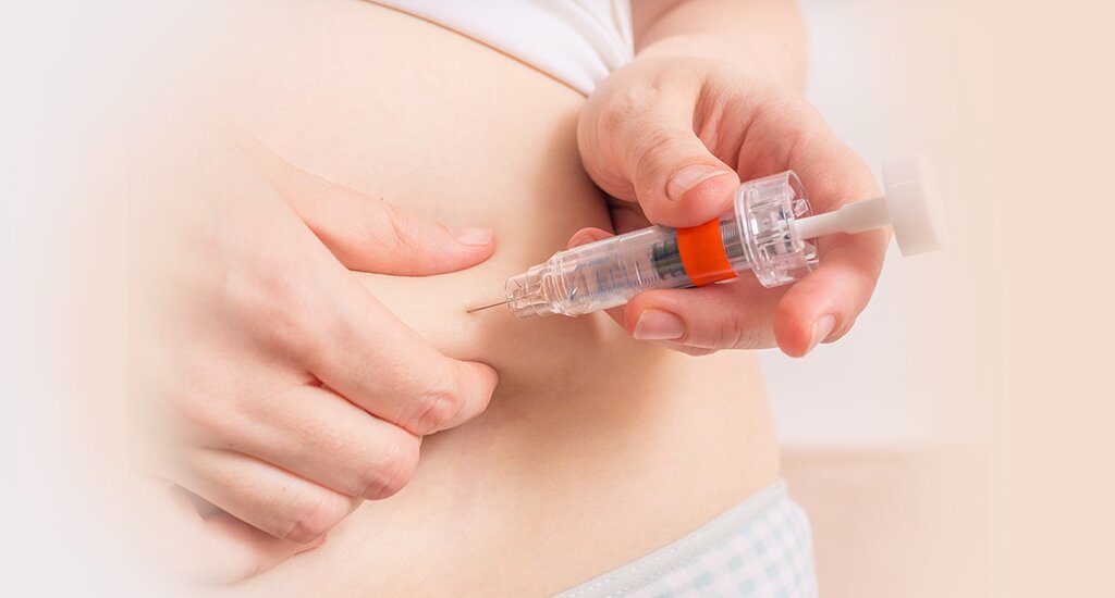 法国代孕机构：写给未出世的你